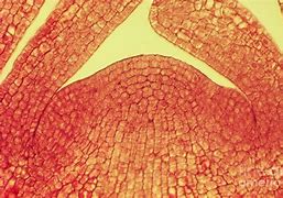 Image result for Apple Cells Microscope