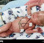 Image result for 10 Week Real Baby