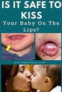 Image result for Kissing Baby Dangerous
