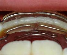 Image result for Spring Clip Retainer