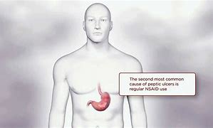 Image result for GI Side Effects Cartoon