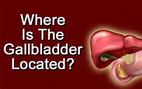 Image result for Where Is My Gallbladder