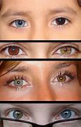Image result for Different Colored Eyes