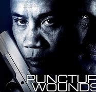 Image result for 7.62 Wound