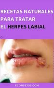 Image result for Herpes Simplex