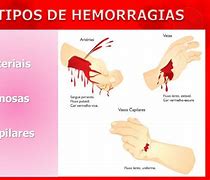 Image result for hemorragia