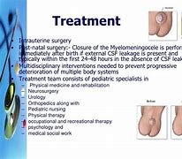 Image result for Lumbar Meningomyelocele