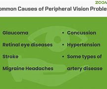 Image result for Peripheral Vision Blurry