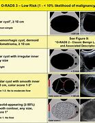 Image result for Ovarian Cyst Size Chart