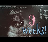 Image result for 9 Week OB Ultrasound