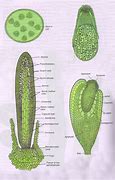 Image result for Bryophyte Sporophyte