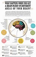 Image result for work memory brain injuries