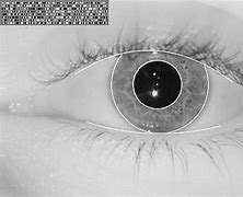 Image result for Crossed Eye Iris Biometrics