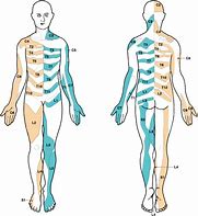 Image result for Pain Dermatome Chart