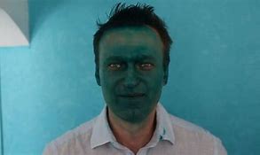 Image result for Navalny Body Eyes Covered
