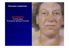fisica medica dispense semeiotica medica facies tiroide dispense fisica medica dispense semeiotica medica facies tiroide dispense