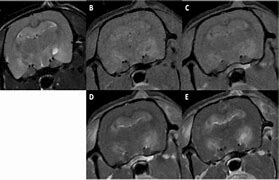 Image result for MRI of Bruised Brain in Long-Term Memory Area