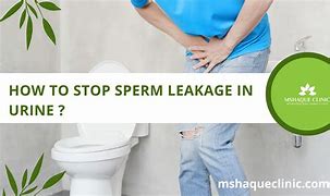 Image result for Spwerm in Urine