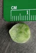 Image result for Pea Size Lump Temple