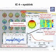Image result for Eye Blink EEG
