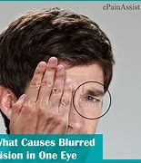 Image result for Blurry Spot in One Eye