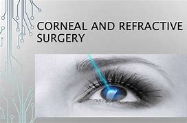 Image result for Refractive Corneal Surgery