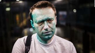 Image result for Blue Faced Navalny