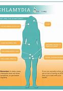 Image result for Chlamydia Disease Symptoms in Women