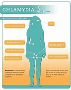 Image result for Chlamydia in Pregnancy