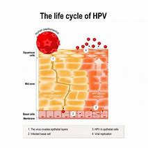 Image result for Genital Human Papillomavirus Stages