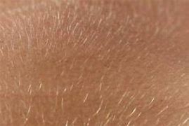 Image result for Vellus Hair Shed