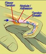 Image result for Touch Screen Bent Fingers