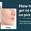 Image result for Ice Pick in the Forehead
