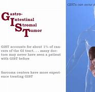 Image result for Gist Tumor