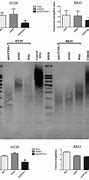 Image result for Chromosome Telomere