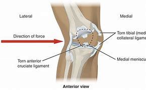 Image result for Knee Laceration