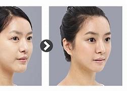 Image result for Sharp Chin Women