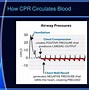 Image result for CPR PPT