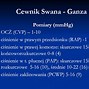 Image result for cewnik_swana ganza