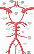 Image result for Picture of Carotid and Vertebral Arteries