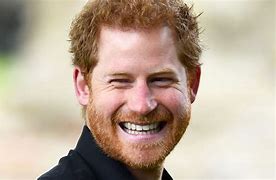 Image result for Prince Harry Teeth