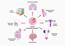 Image result for Bacterial Infection. N