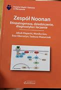 Image result for co_oznacza_zespół_noonan