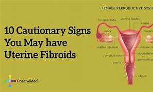 Image result for Fibroids Netter