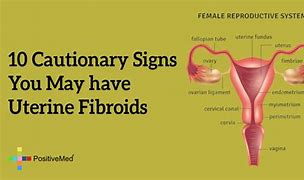 Image result for 14 Cm Fibroid