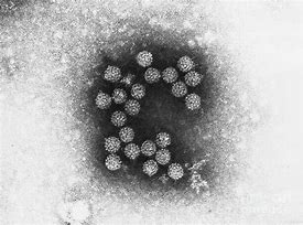 Image result for Papillomavirus Warts