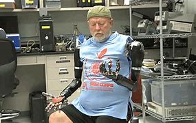 Image result for Prosthetic Limbs Life Like
