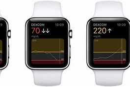 Image result for Dexcom G7 Apple Watch Complications