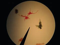 Image result for Amoeba Under Microscope 100X