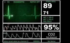Image result for Heart Rate Monitor Flatline